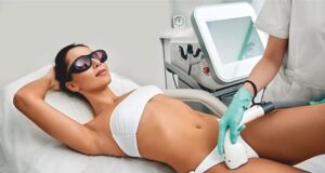 EPILAZIONE AL LASER