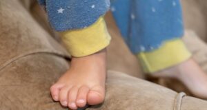 Le alterazioni delle unghie dei bambini