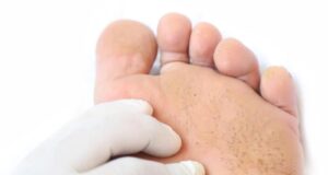 PUNTINI SOTTO LA PIANTA DEL PIEDE?